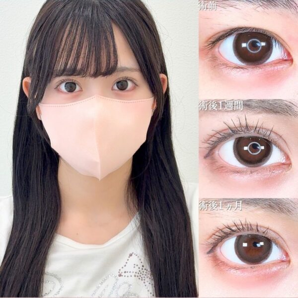 No.16722の症例写真